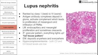 Glomerular diseases [upl. by Stander862]