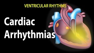 Cardiac Arrhythmias Animation [upl. by Mayne406]