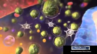 Acute Lymphocytic Leukemia ALL Animation [upl. by Elyc427]