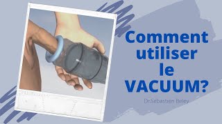 Dr Sébastien Beley Comment utiliser le vacuum [upl. by Cann815]