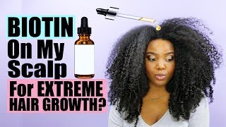 Putting Biotin On Your Scalp For EXTREME Hair Growth  Natural Hair [upl. by Kone]