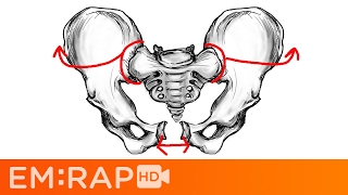 Chronic Pelvic Pain  Gynaecology [upl. by Hynes]