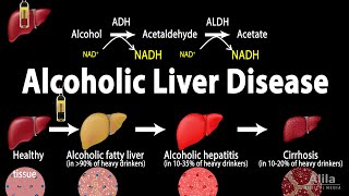 Alcoholic Liver Disease Animation [upl. by Morganstein]