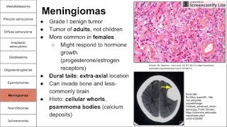 Nervous System Tumors [upl. by Ledeen]